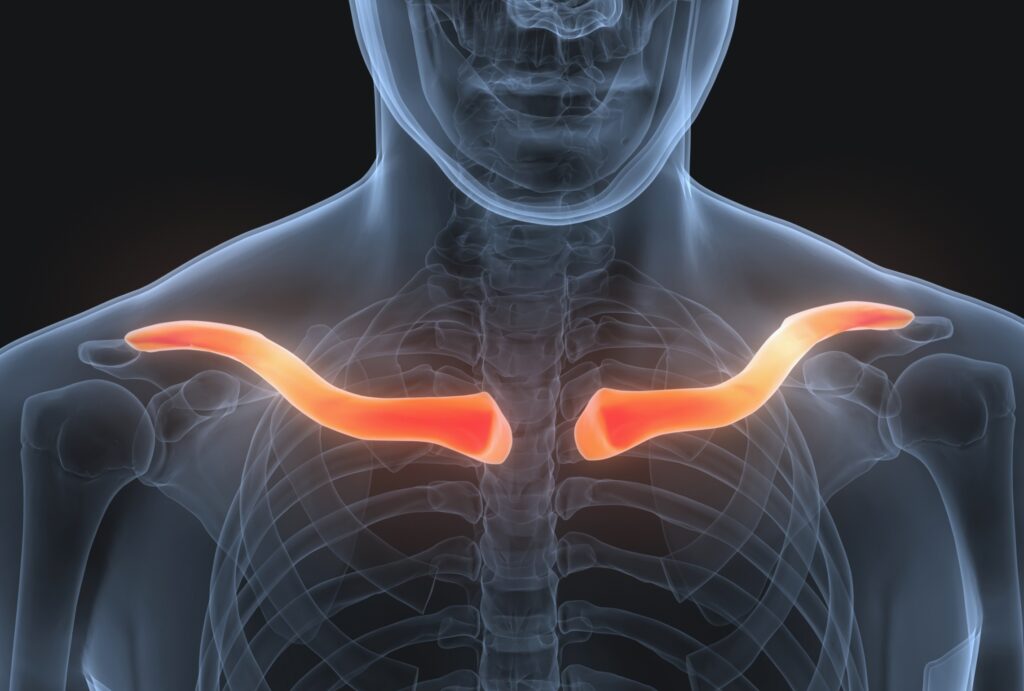 Fracture de la clavicule cause et traitement Dr Salabi Marseille