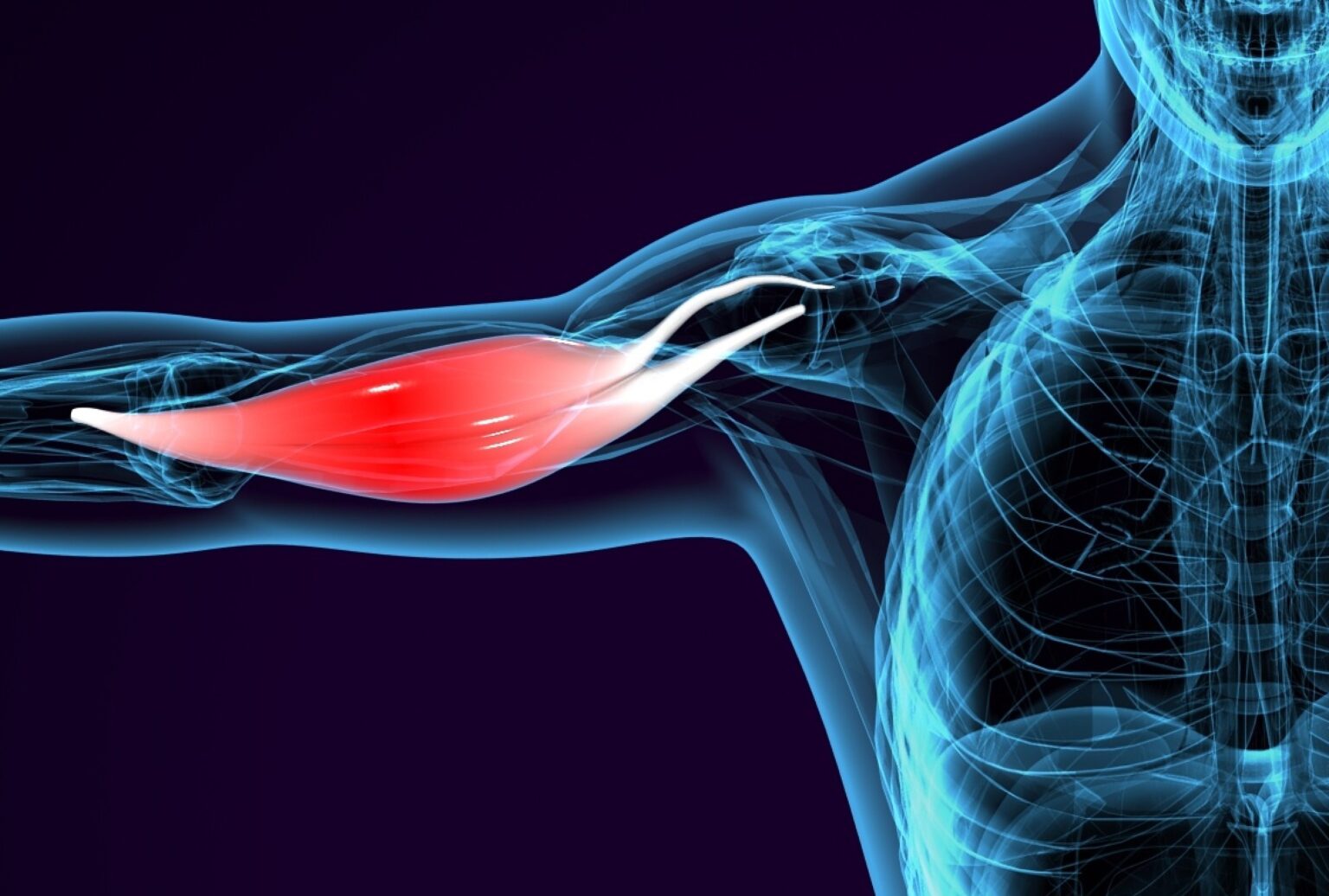 Réinsertion du biceps distal le guide complet Dr Salabi Marseille
